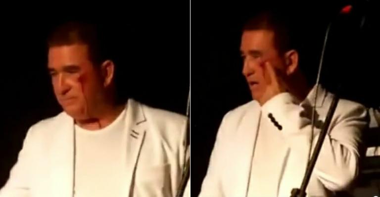 Amado Batista é agredido em show e deixa palco com o rosto sangrando