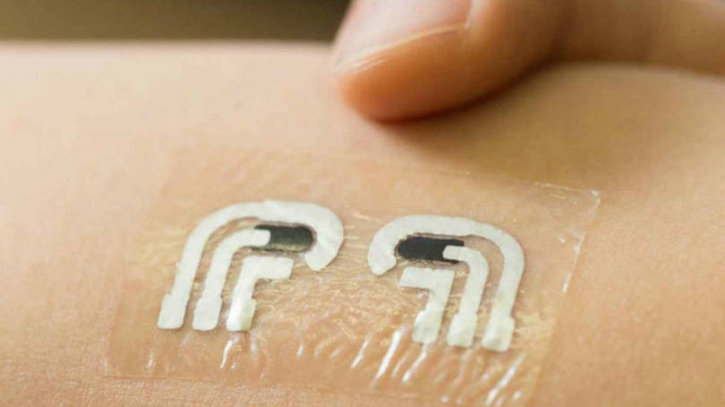 Tatuagem temporária mede nível de açúcar no sangue